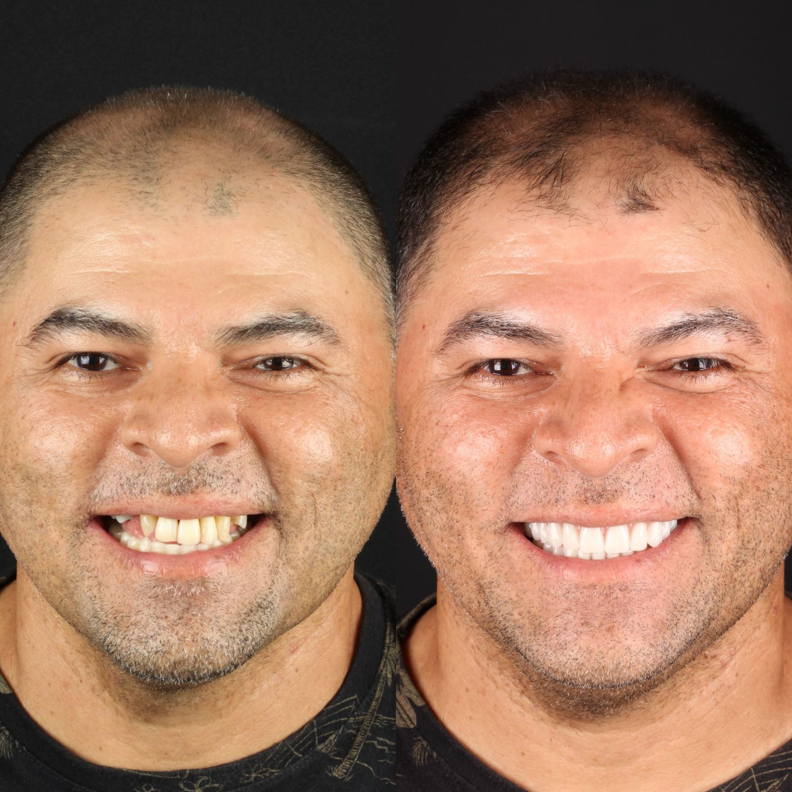 Antes e depois — paciente da Clínica Reabilitar